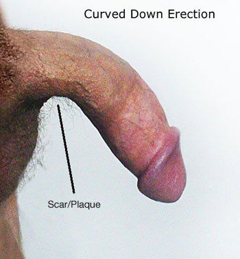 Downwards curved dick porn