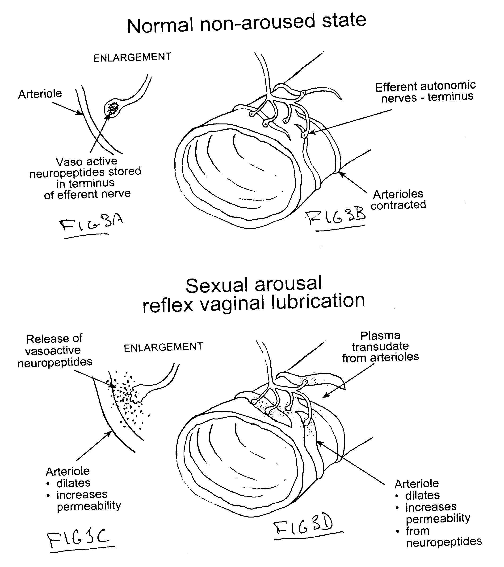 best of Vagina vs Aroused vagina normal