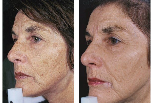 best of Facial treatments Rejuvenating