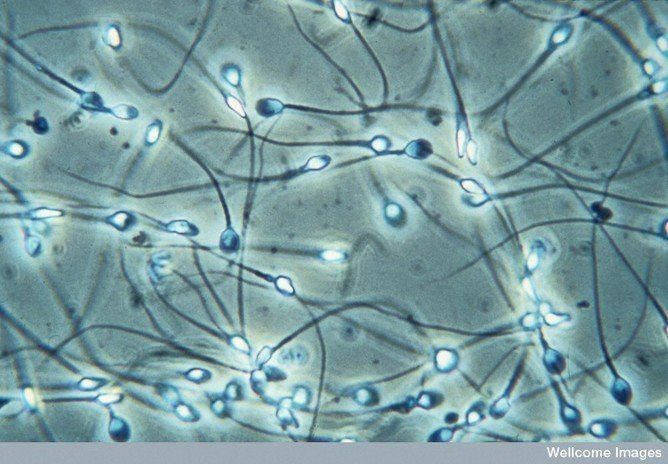 Sperm size under the microscope