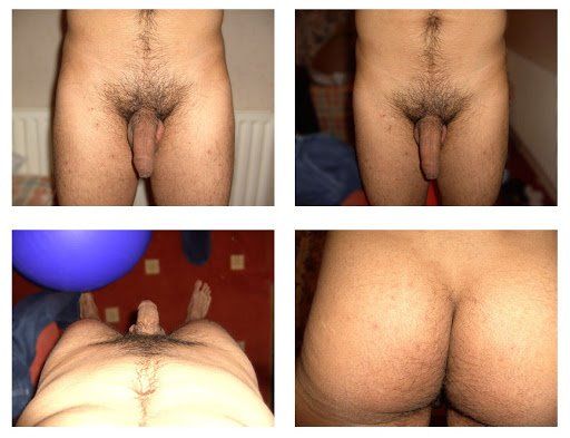 Hair removal rectum anus - Porn pictures