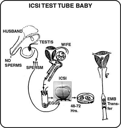 best of Testicles sperm for the fertilization from Extraction of