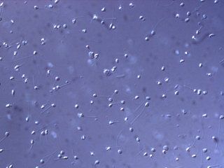 Sperm size under the microscope