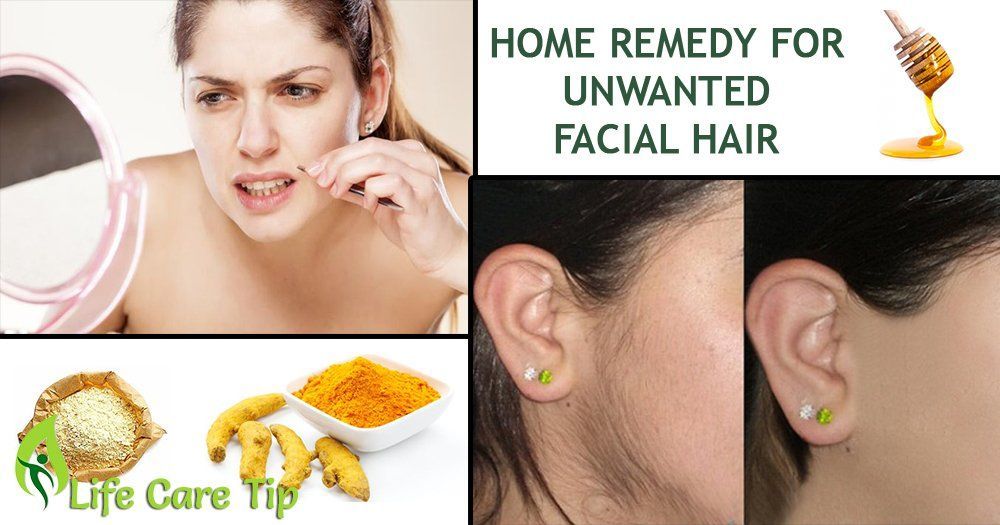 Sticks reccomend Treatment for female facial hair