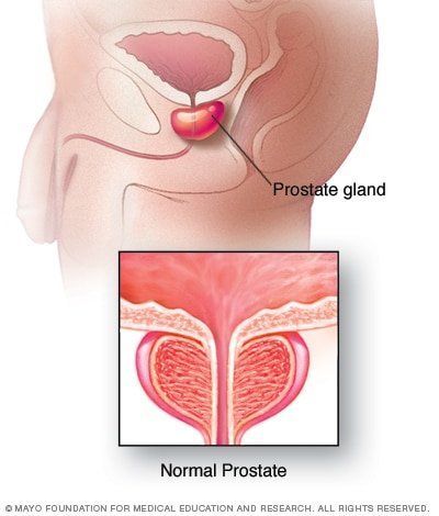 Good D. reccomend Relieve congestive prostatitis huge orgasm