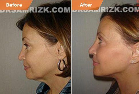 best of Of surgeon cosmetic plastic Best 2007 philly facial