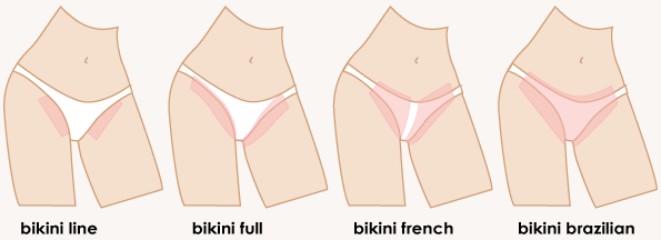 Bikini Brazilian Shave - Nude Photos