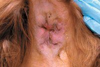 best of Canine anal fistulas Protopic for