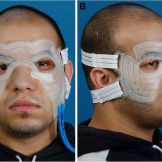 Electric B. reccomend Facial pain zygo