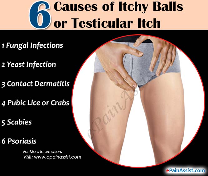 Cure for itchy anus