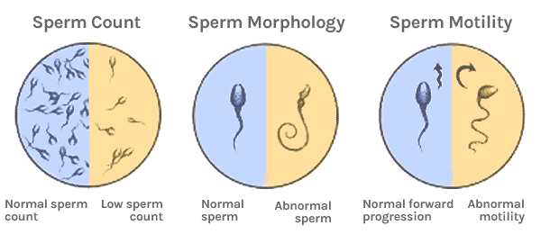 Interpretation of sperm analysis