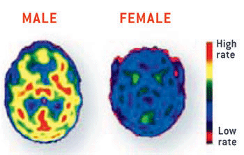 Brain during orgasm - Real Naked Girls