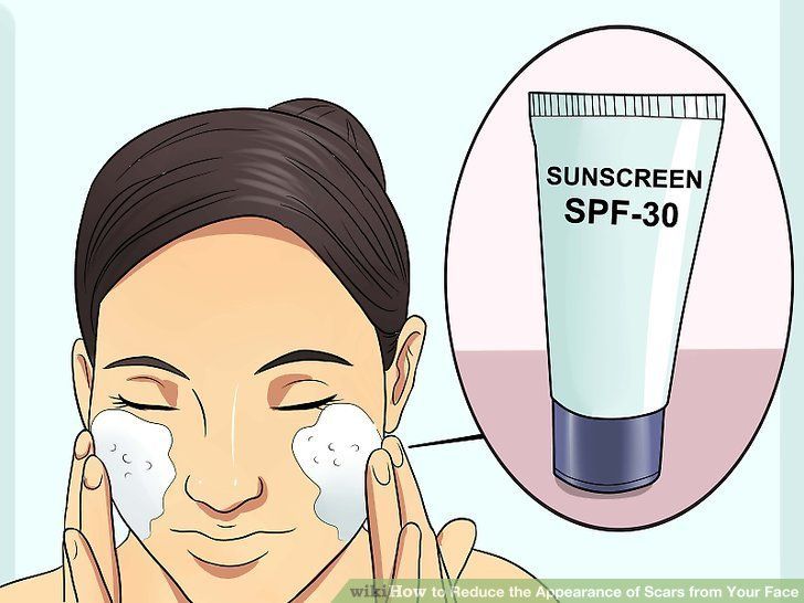 Prevent facial scarring