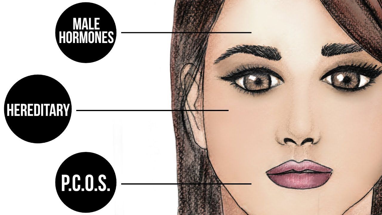 Koi reccomend Reasons for facial hair in women
