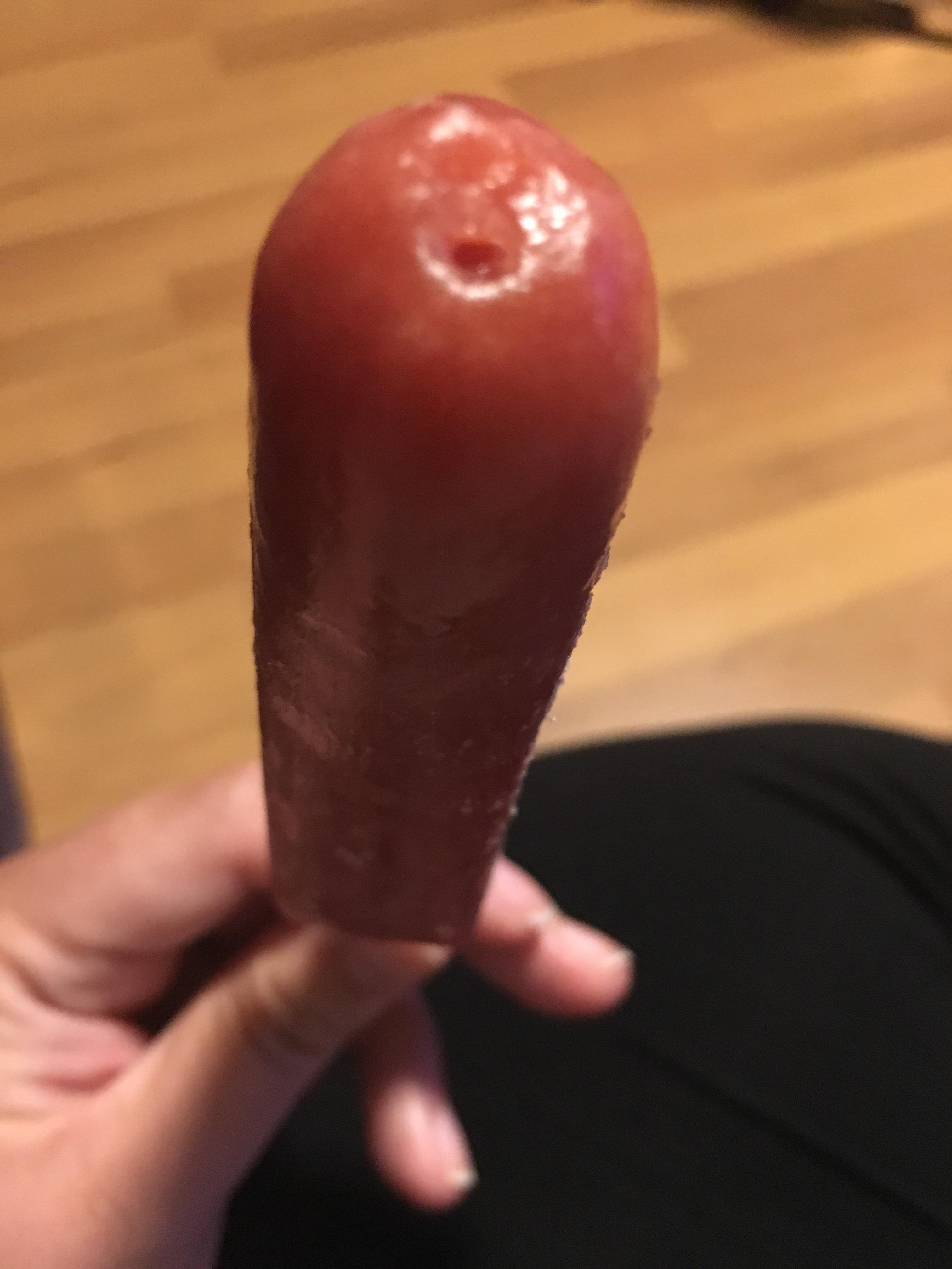 Redness around penis pee hole