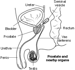 Relieve congestive prostatitis huge orgasm